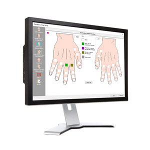 ESW Upper Extremity Evaluation Software
